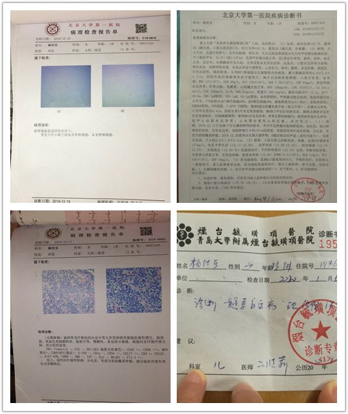 外地社保怎么转移烟台的？—一篇详细指南