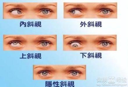 儿童斜视手术医保报销攻略